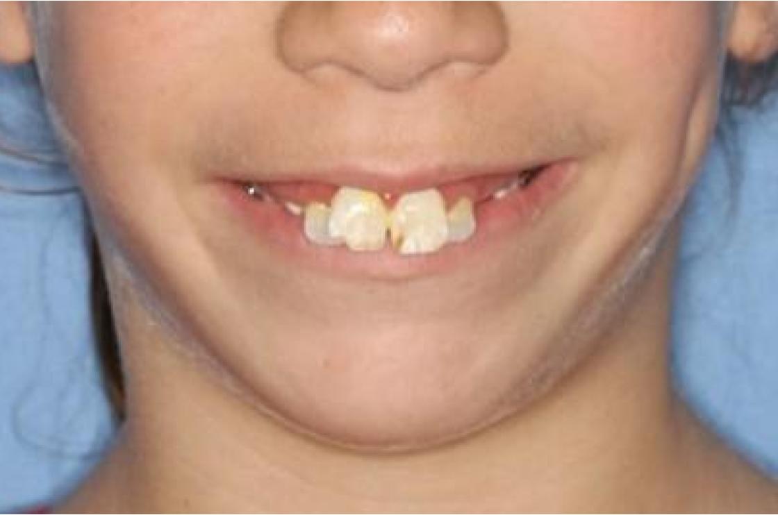 דוגמאות נוספות - לפני ואחרי 2