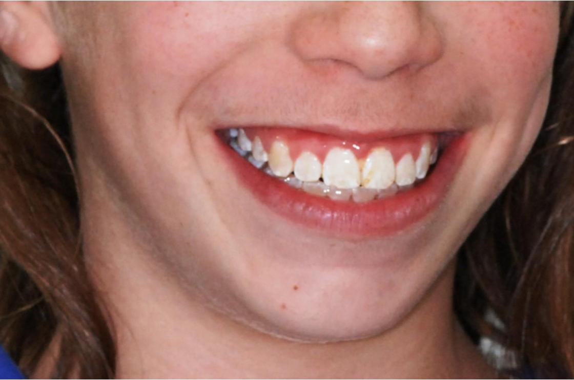 דוגמאות נוספות - לפני ואחרי 1