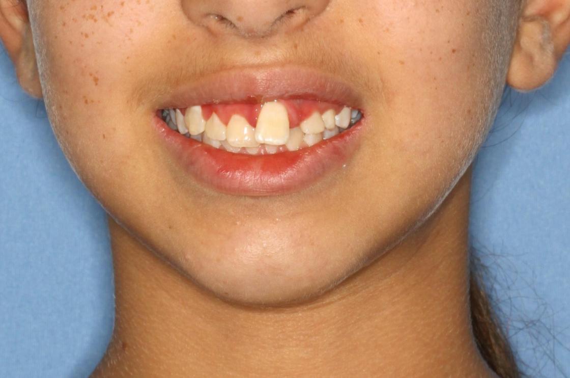 דוגמאות נוספות - לפני ואחרי 4