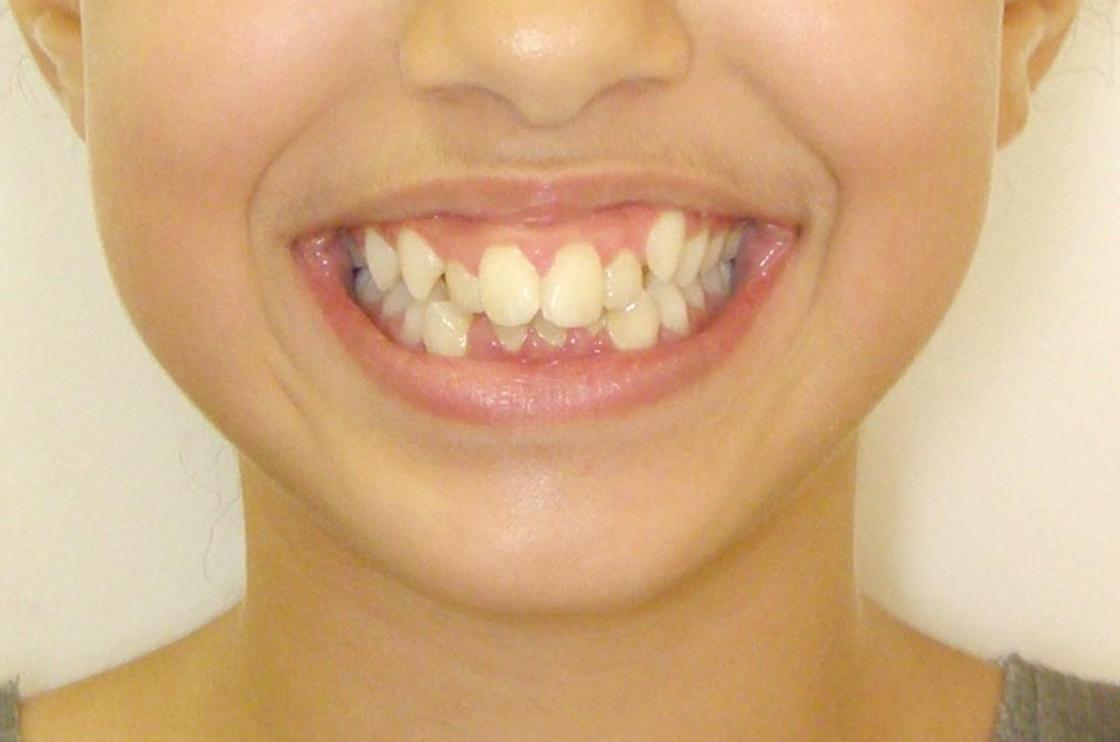 דוגמאות נוספות - לפני ואחרי 6