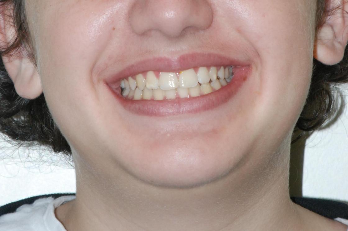 דוגמאות נוספות - לפני ואחרי 7