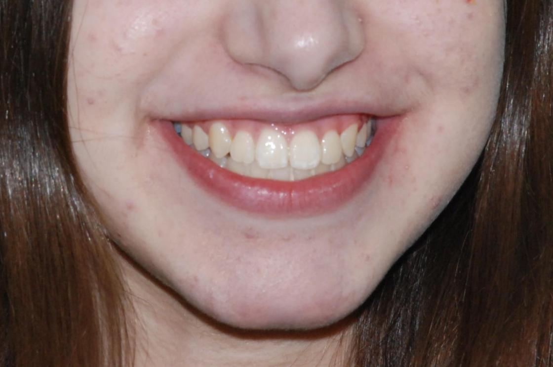 דוגמאות נוספות - לפני ואחרי 9