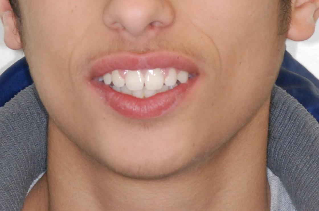 דוגמאות נוספות - לפני ואחרי 11