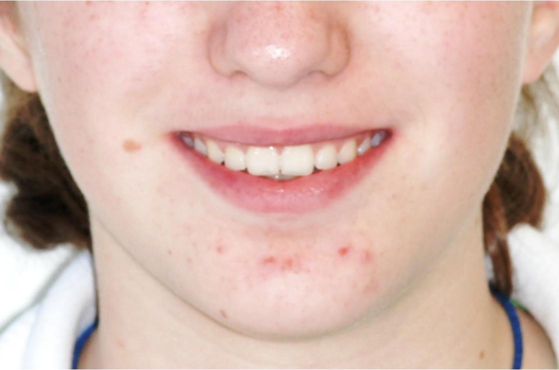 דוגמאות נוספות - לפני ואחרי 15